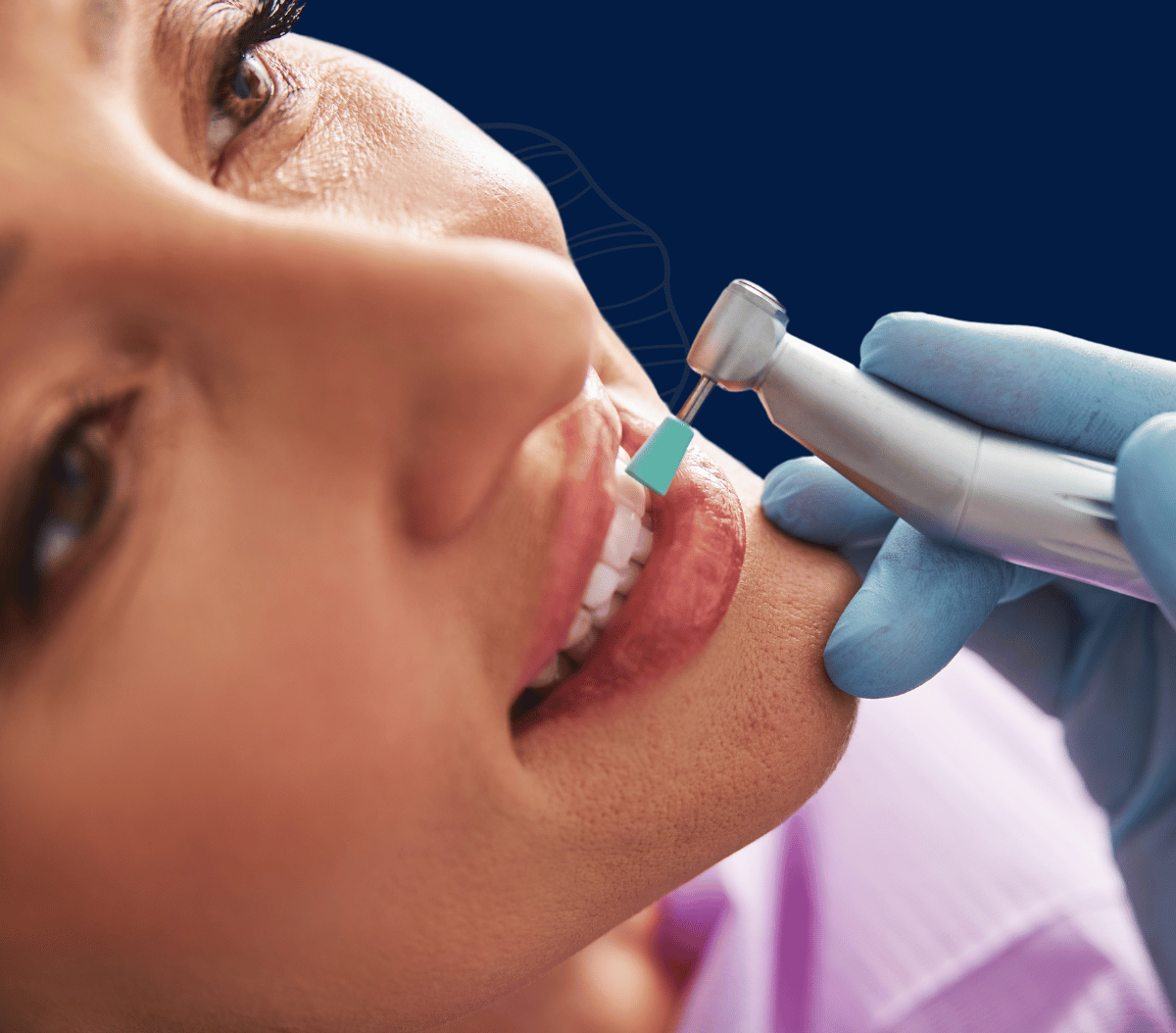 Treatment - Infinity Dental Solihull